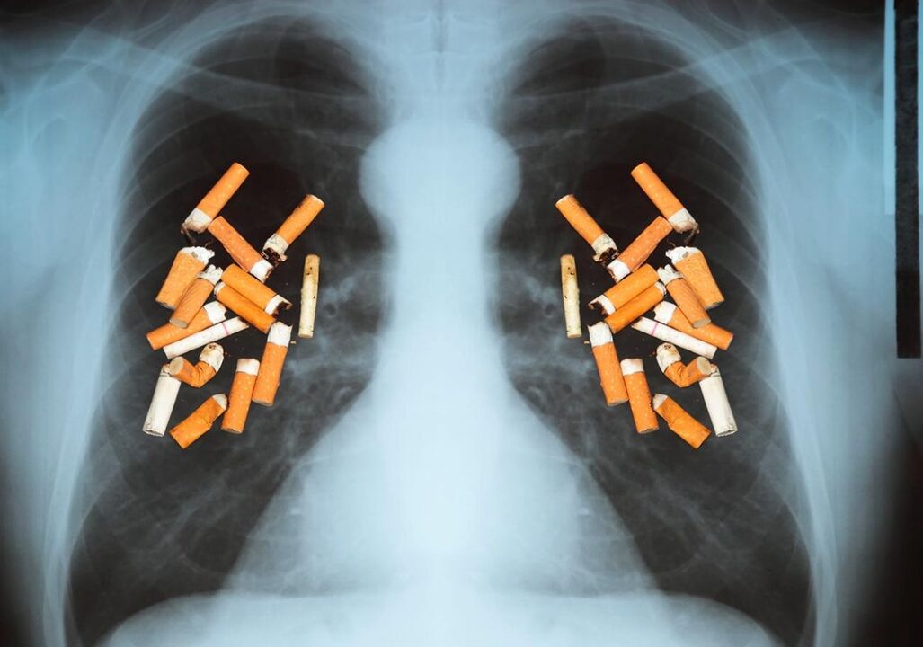Jak cigarety ovlivňují plíce